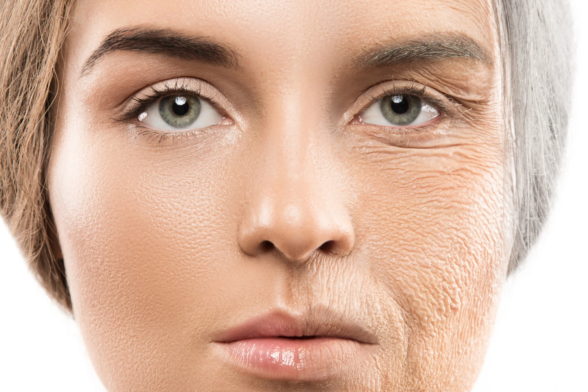 Fine Lines and Wrinkles