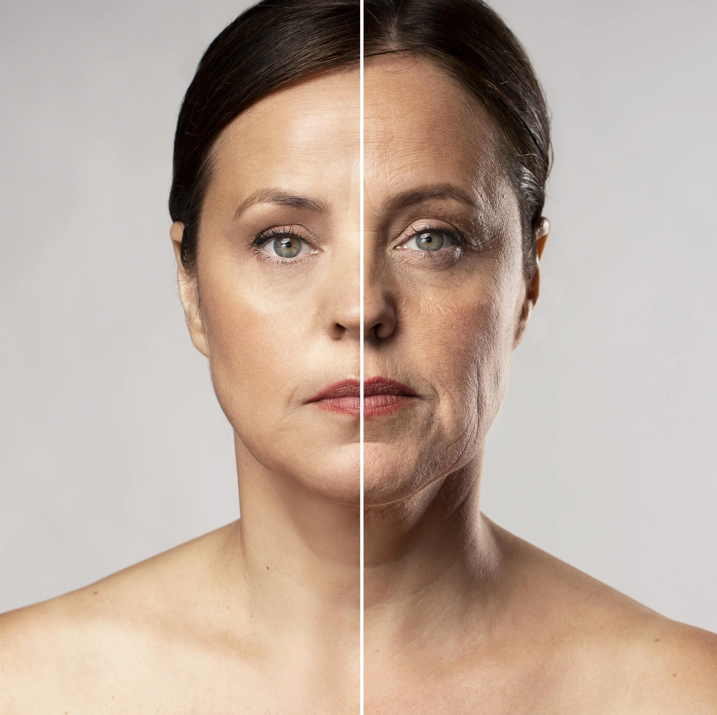 Collagen Induction Treatment in Jaipur