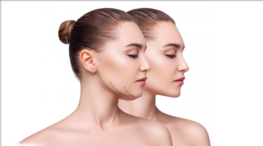 Double Chin Reduction Treatment in Jaipur