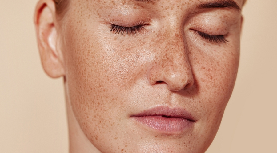 Pigmentation Treatment