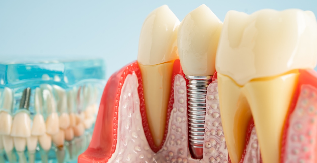 Prosthodontics